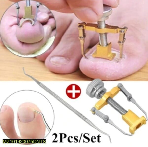 1 Set Professional Effective Treatment Ingrown Toenail Correction Pedicure Tools